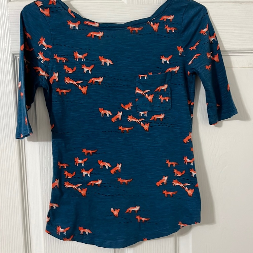 9.HIS STCL top.